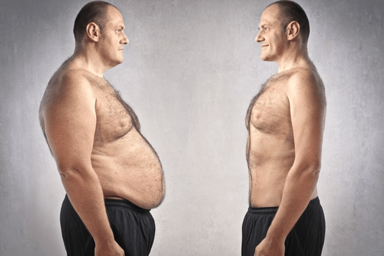 overweight with prostate